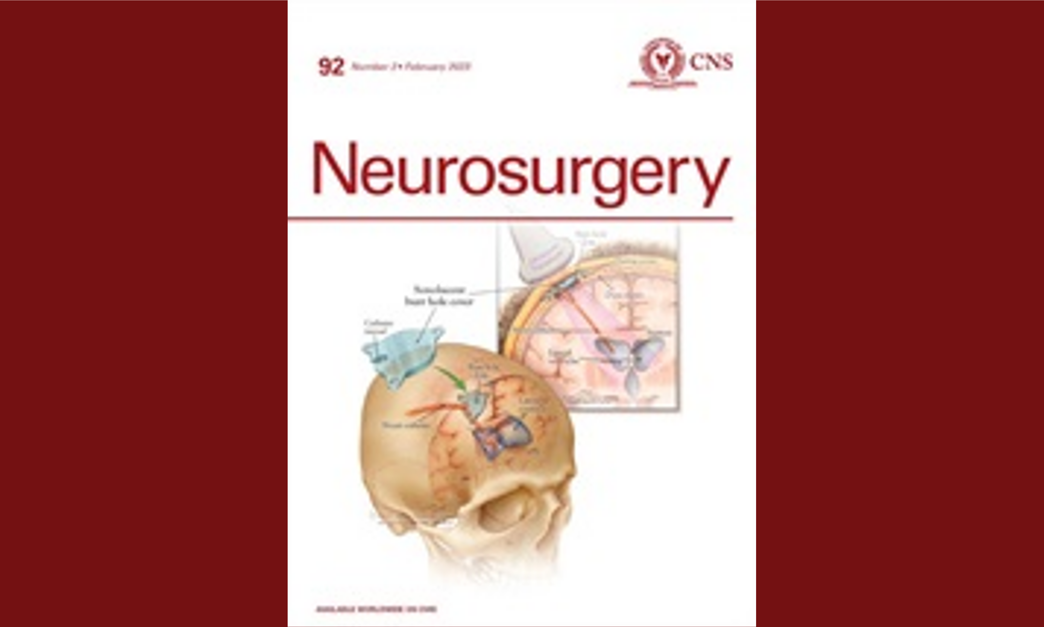 Survival, Dependency, and Health-Related Quality of Life in Patients With Ruptured Intracranial Aneurysm: 10-Year Follow-up of the United Kingdom Cohort of the International Subarachnoid Aneurysm Trial